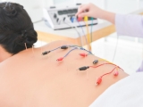 Châm cứu đông y có tác dụng gì?